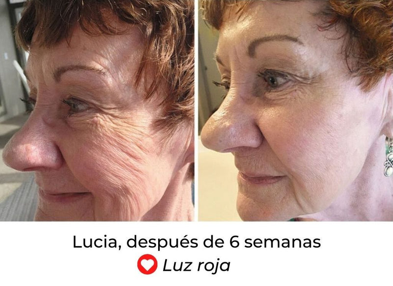 Mascarilla Terapéutica Rejuvenecedora LED